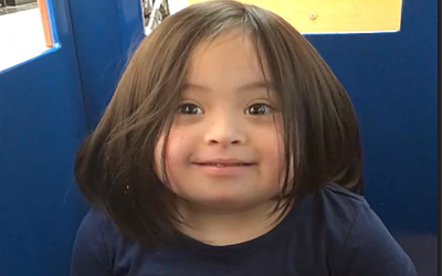 Erick: Down syndrome